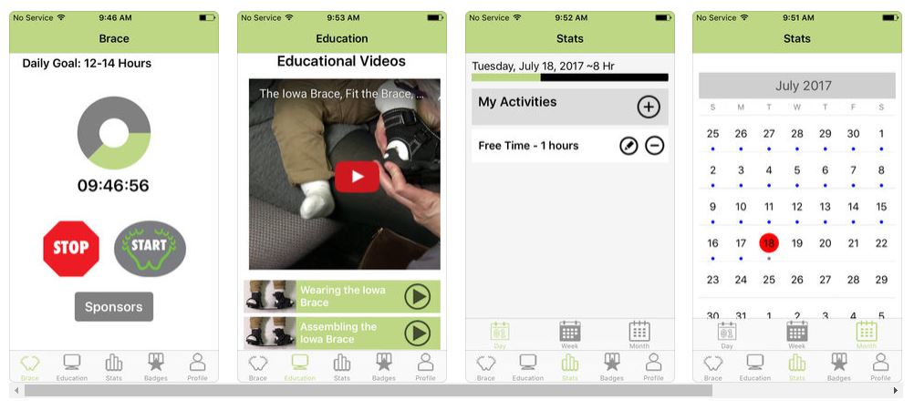 Clubfoot Solutions app