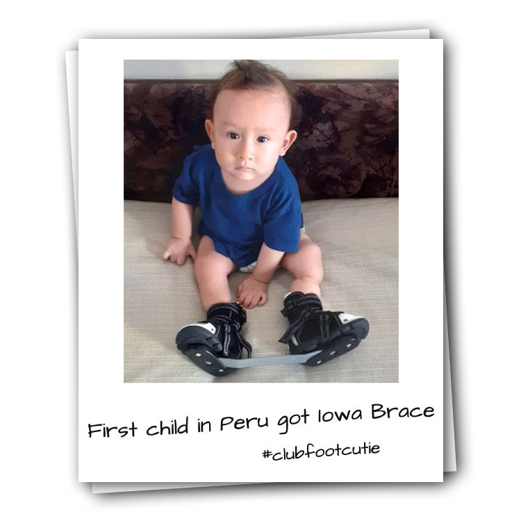 Peru child gets Iowa Brace